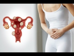 Симптомы миомы матки, о которых должна знать каждая женщина