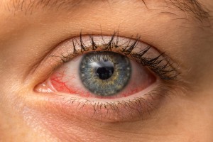 Виды заболеваний глаз